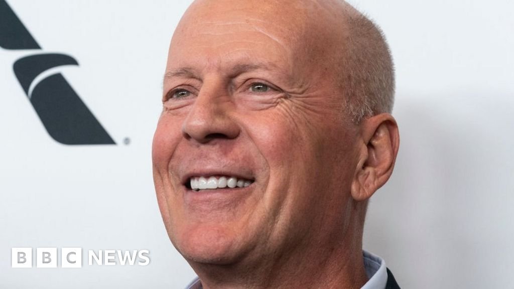 Bruce Willis has dementia, family announces