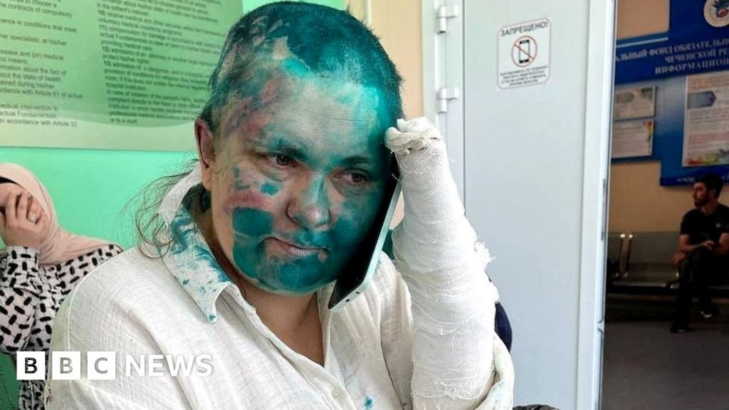 Chechnya Milashina attack: Armed thugs beat up Russian journalist and lawyer